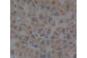 Image no. 2 for anti-Protein S (PROS) (AA 301-476) antibody (ABIN1175271)