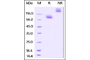 Image no. 2 for Interleukin 7 Receptor (IL7R) (AA 21-236) (Active) protein (Fc Tag,AVI tag,Biotin) (ABIN4949034)