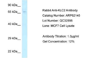 Image no. 1 for anti-Kinesin Light Chain 2 (KLC2) (C-Term) antibody (ABIN2789036)