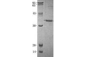 Image no. 1 for Prostate Specific Antigen (PSA) (Transcript Variant 3) protein (His tag) (ABIN2723968)