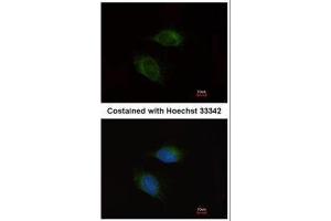 ICC/IF Image Immunofluorescence analysis of methanol-fixed HeLa, using MMP9, antibody at 1:200 dilution.