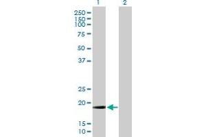 Image no. 1 for anti-Mitochondrial Ribosomal Protein L13 (MRPL13) (AA 1-178) antibody (ABIN526051)