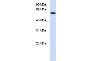 Image no. 1 for anti-Asparagine-Linked Glycosylation 6, alpha-1,3-Glucosyltransferase Homolog (ALG6) (N-Term) antibody (ABIN2782790)