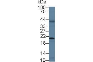 Western Blot; Sample: Human A431 cell lysate; Primary Ab: 1µg/ml Rabbit Anti-Mouse CANT1 Antibody Second Ab: 0.
