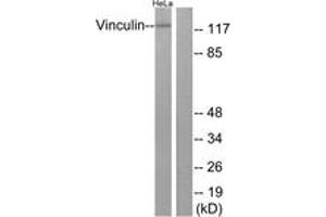 Image no. 1 for anti-Vinculin (VCL) (AA 786-835) antibody (ABIN1532662)