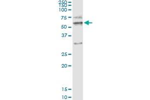 anti-Matrix Metallopeptidase 12 (Macrophage Elastase) (MMP12) (AA 1-470) antibody