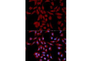 Image no. 4 for anti-Ubiquitin-Conjugating Enzyme E2I (UBE2I) antibody (ABIN3023178)