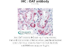 Image no. 2 for anti-Ornithine Aminotransferase (OAT) antibody (ABIN1724371)