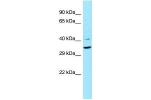 Image no. 1 for anti-Keratin 9 (KRT9) (N-Term) antibody (ABIN2789856)