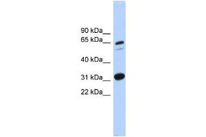 Image no. 1 for anti-Integrin alpha FG-GAP Repeat Containing 3 (ITFG3) (Middle Region) antibody (ABIN2784023)
