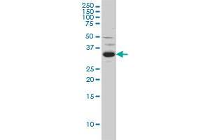 SPRY2 anticorps  (AA 1-315)