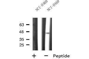 Image no. 1 for anti-Pyruvate Dehydrogenase (Lipoamide) alpha 2 (PDHa2) (C-Term) antibody (ABIN6259275)