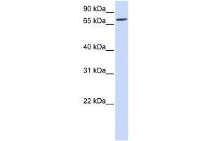 Image no. 1 for anti-Interleukin 1 Receptor Accessory Protein-Like 2 (IL1RAPL2) (Middle Region) antibody (ABIN635701)