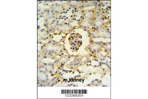 Image no. 2 for anti-Peptidase (Mitochondrial Processing) beta (PMPCB) (AA 18-46), (N-Term) antibody (ABIN651181)