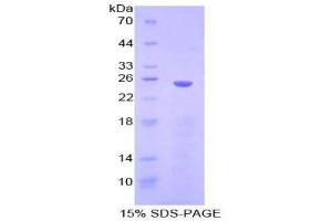 Image no. 1 for Inhibitor of KB Kinase beta Interacting Protein (IKbIP) (AA 132-314) protein (His tag) (ABIN1879415)