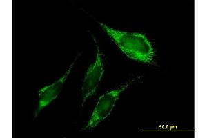 Immunofluorescence of purified MaxPab antibody to PNPT1 on HeLa cell.