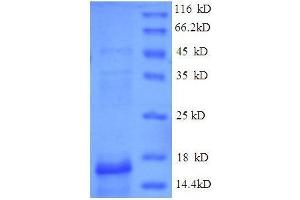 ESAT-6-Like Protein EsxB (AA 2-100), (full length) protein (His tag)