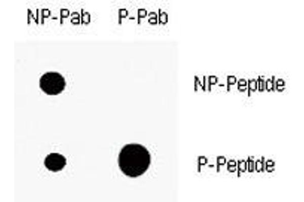 anti-Cyclin-Dependent Kinase Inhibitor 1A (p21, Cip1) (CDKN1A) (pThr145) antibody