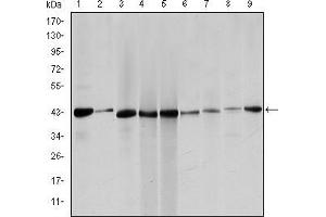 Image no. 4 for anti-Actin, alpha 2, Smooth Muscle, Aorta (ACTA2) antibody (ABIN968945)