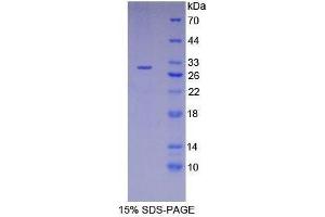 Image no. 1 for Receptor-Interacting serine-threonine Kinase 3 (RIPK3) (AA 16-239) protein (His tag) (ABIN1879214)