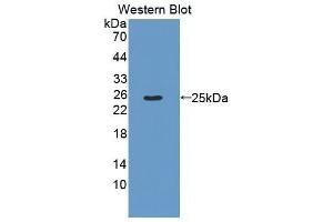 Image no. 1 for anti-Noggin (NOG) (AA 28-232) antibody (ABIN1175550)