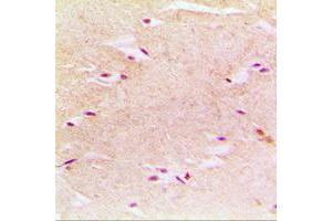 Image no. 1 for anti-Peroxisomal Biogenesis Factor 14 (PEX14) (Center) antibody (ABIN2706796)