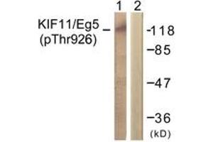 Western blot analysis of extracts from COLO205 cells, using KIF11/Eg5 (Phospho-Thr926) Antibody.