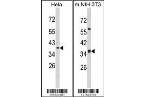 Image no. 1 for anti-8-Oxoguanine DNA Glycosylase (OGG1) (AA 318-345), (C-Term) antibody (ABIN390918)