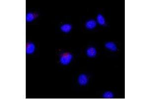 Image no. 5 for anti-TAF1 RNA Polymerase II, TATA Box Binding Protein (TBP)-Associated Factor (TAF1) (AA 103-123) antibody (ABIN2452155)