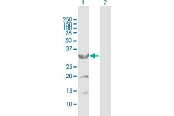 CYB5R3 Antikörper  (AA 1-301)