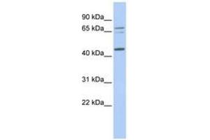 Image no. 1 for anti-Queuine tRNA-Ribosyltransferase 1 (QTRT1) (AA 252-301) antibody (ABIN6741051)