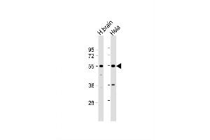 Image no. 2 for anti-Trk-Fused Gene (TFG) (AA 85-114) antibody (ABIN1538691)