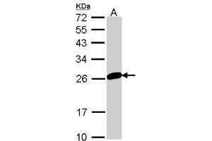 Image no. 1 for anti-MAD2 Mitotic Arrest Deficient-Like 1 (Yeast) (MAD2L1) (Center) antibody (ABIN2856908)