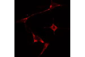 Image no. 1 for anti-Heat Shock 27kDa Protein 2 (HSPB2) (Internal Region) antibody (ABIN6258481)