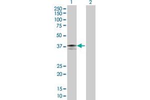 Image no. 1 for anti-Interleukin 4 Receptor (IL4R) (AA 1-227) antibody (ABIN517022)