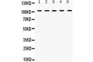 Image no. 2 for anti-Tripartite Motif Containing 28 (TRIM28) (AA 699-835) antibody (ABIN3043491)
