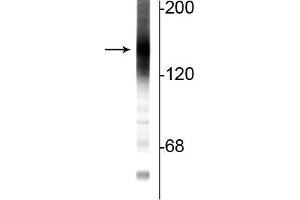 Image no. 1 for anti-Adenylate Cyclase 3 (ADCY3) (C-Term) antibody (ABIN6254060)