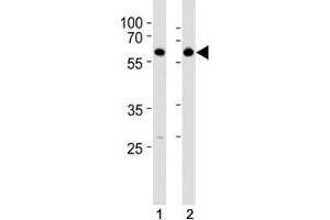Image no. 4 for anti-Histone Deacetylase 2 (HDAC2) (AA 410-439) antibody (ABIN3031225)