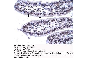 Image no. 2 for anti-Myogenic Factor 6 (MYF6) (N-Term) antibody (ABIN2779472)