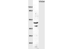 Image no. 1 for anti-Acetylserotonin O-Methyltransferase (ASMT) antibody (ABIN873275)