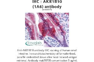 Image no. 3 for anti-Aldo-Keto Reductase Family 1, Member B10 (Aldose Reductase) (AKR1B10) (AA 76-144) antibody (ABIN1723592)