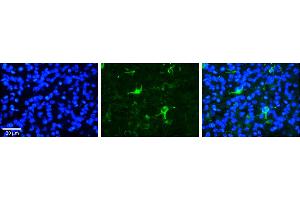 Image no. 7 for anti-F-Box and WD Repeat Domain Containing 7 (FBXW7) (C-Term) antibody (ABIN2782955)