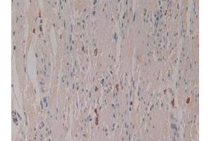 Detection of LEAP2 in Human Rectum Tissue using Polyclonal Antibody to Liver Expressed Antimicrobial Peptide 2 (LEAP2)