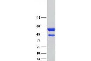 Image no. 1 for CAP, Adenylate Cyclase-Associated Protein 1 (CAP1) (Transcript Variant 2) protein (Myc-DYKDDDDK Tag) (ABIN2713109)