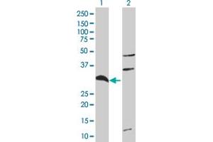 Image no. 1 for anti-Tumor Necrosis Factor-Inducible Protein 6 (TNFAIP6) (AA 1-277) antibody (ABIN5589786)