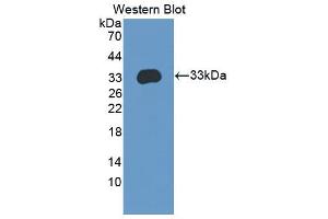 Image no. 2 for anti-Integrin beta 4 (ITGB4) (AA 1098-1356) antibody (ABIN5013754)