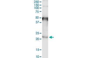 Image no. 2 for anti-Transmembrane Protein 86B (TMEM86B) (AA 1-226) antibody (ABIN1327269)
