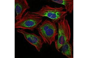 Image no. 3 for anti-Protein Phosphatase 2A Activator, Regulatory Subunit 4 (PPP2R4) antibody (ABIN5586075)
