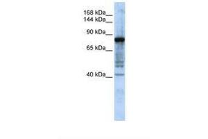 Image no. 1 for anti-Hephaestin (HEPH) (N-Term) antibody (ABIN6738306)