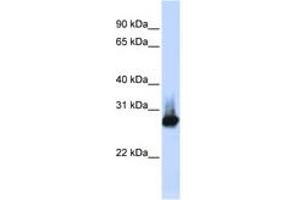 Image no. 1 for anti-B-Cell Receptor-Associated Protein 31 (BCAP31) (C-Term) antibody (ABIN6749735)